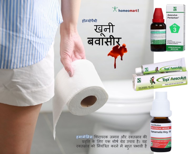 खूनी बवासीर की दवा होम्योपैथी, पाइल्स मेडिसिन