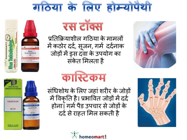 गाउट (वातरक्त) के लक्षण इलाज, दवा