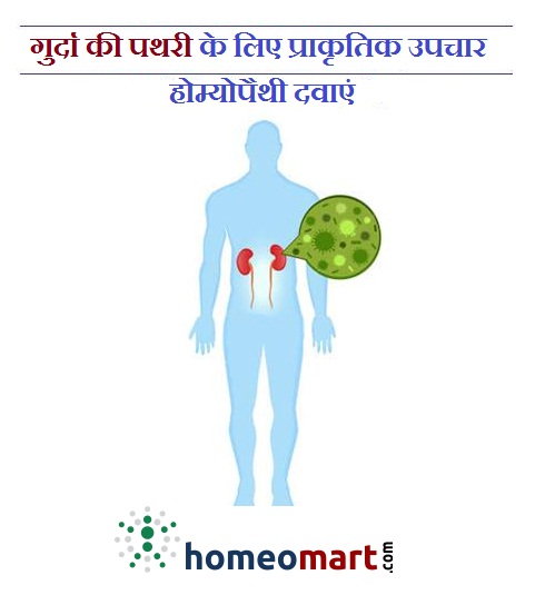 kidney stones treatment in hindi