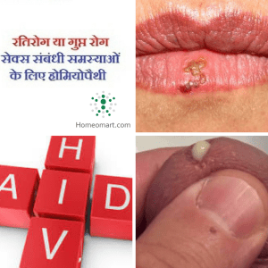 Gupt Rog, STD, Yon Rog ki upachar hindi