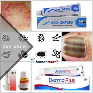 ringworm medicine hindi, cream for red, itchy, peeling skin rashes