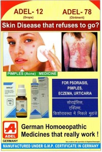 pimples eczema psoriasis medicine in hindi