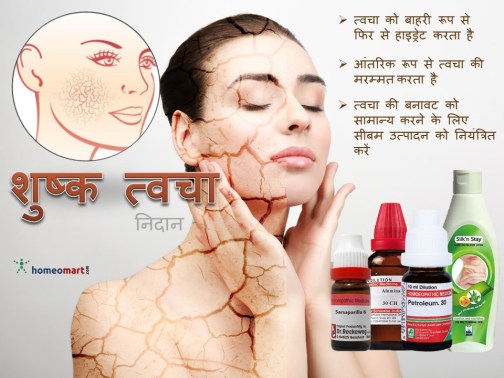होम्योपैथी में शुष्क त्वचा का इलाज