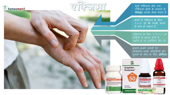 एक्जिमा रोग को जड़ से इलाज
