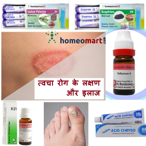 tvacha rog ka ilaj skin disease medicine hindi