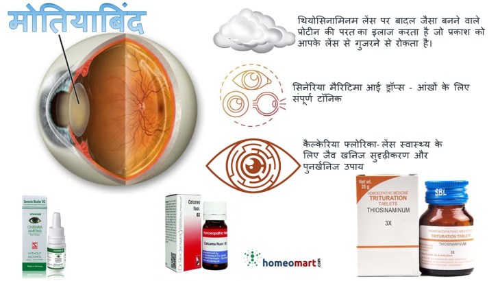 सर्जरी के बिना मोतियाबिंद का इलाज