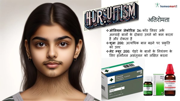 अतिरोमता का लक्षण और इलाज