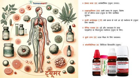 ट्यूमर कहां-कहां होता है