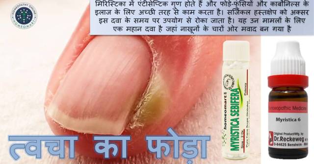 fode funsi ka gharelu ilaj in hindi, skin boils medicines in hindi