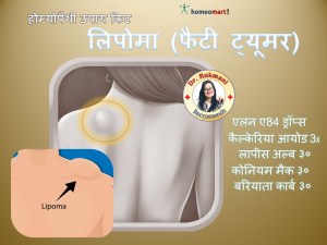 Lipoma treatment in Hindi, लिपोमा के लिए होम्योपैथी