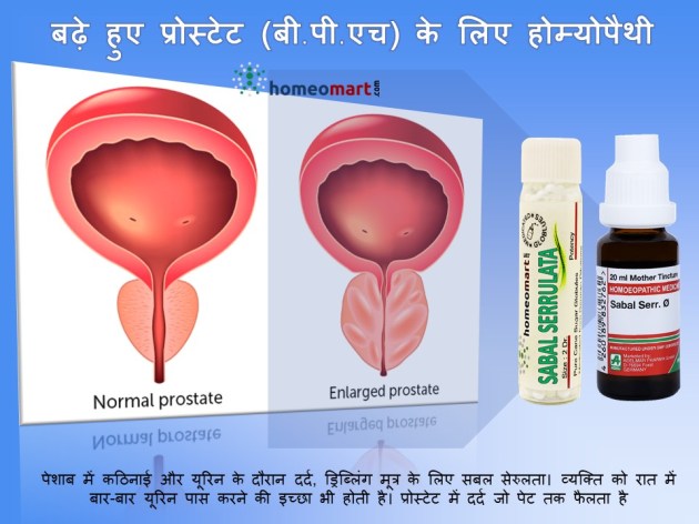 prostatitis medicines in hindi प्रोस्टेट की रामबाण दवा in hindi प्रोस्टेट इन्फेक्शन के लक्षण प्रोस्टेट की रामबाण दवा