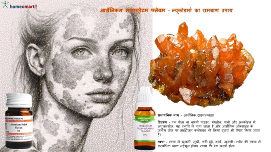 ल्यूकोडर्मा सफेद दाग (स्वित्र) उपचार 