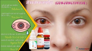 कंजंक्टिवाइटिस की दवाएं