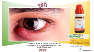 स्टाई स्टाई होम्योपैथी दवाएं होम्योपैथी दवाएं