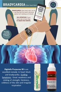ब्रैडीकार्डिया स्लो पल्स ट्रीटमेंट धीमी हृदय गति होम्योपैथी उपचार