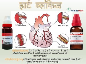 हार्ट में ब्‍लॉकेज होने के लक्षण, कारण और बचने के प्राकृतिक तरीके