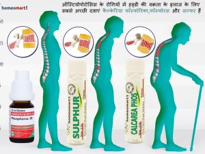 ऑस्टियोपोरोसिस के घरेलू उपचार,हड्डियों की सबसे आम समस्या है, ऑस्टियोपोरोसिस की दवा
