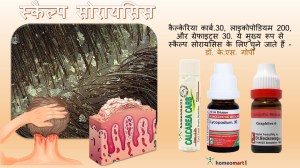 सोरायसिस फोटो, अपरस की होम्योपैथिक दवा