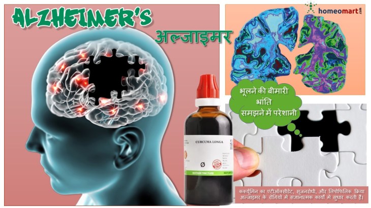 अल्जाइमर रोग की रोकथाम