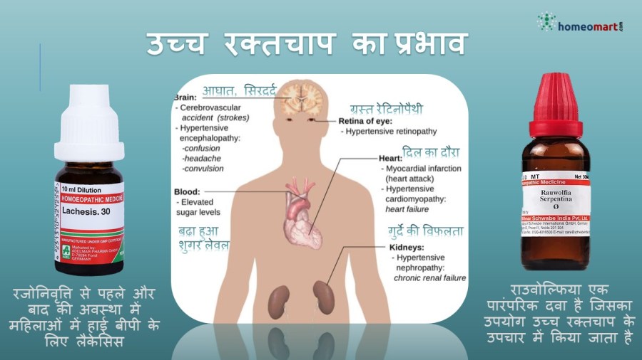 बीपी बढ़ने से क्या होता है, हाई ब्लड प्रेशर के लक्षण और उपचार, हाई ब्लड प्रेशर के नुकसान