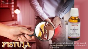 फिस्टुला से राहत की होम्योपैथी दवा