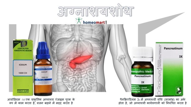 पैंक्रियास ठीक करने के उपाय