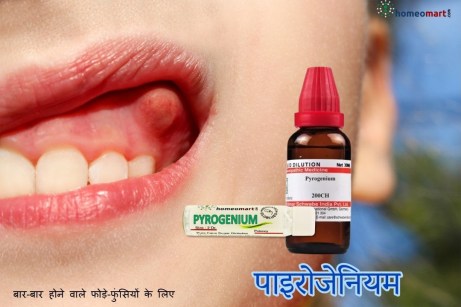 मसूड़ों में गांठ होना