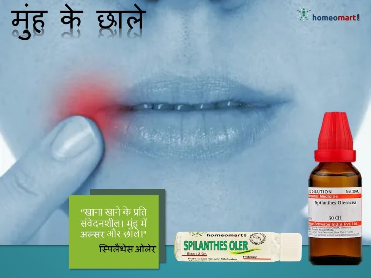 मुंह में घाव का इलाज