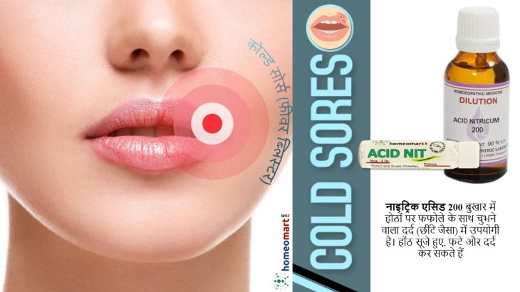 कोल्ड सोर्स का खुद इलाज करने के तरीके