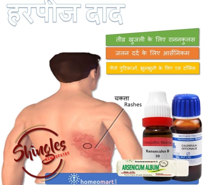 हर्पीस वायरस पिक्चर्स