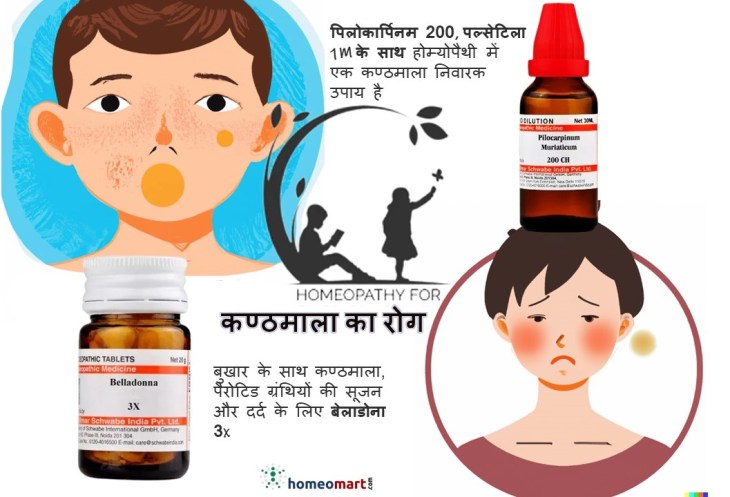 गलसुआ का खुद इलाज करने के तरीके