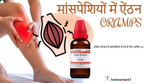 मांसपेशियों की ऐंठन से राहत होम्योपैथी दवाएं