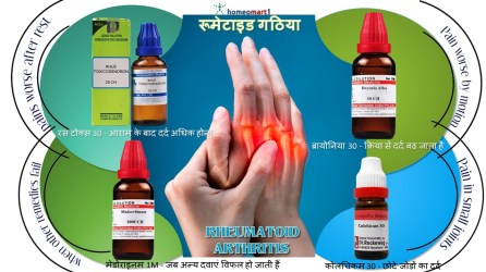 रूमेटाइड गठिया का खुद इलाज करने के तरीके