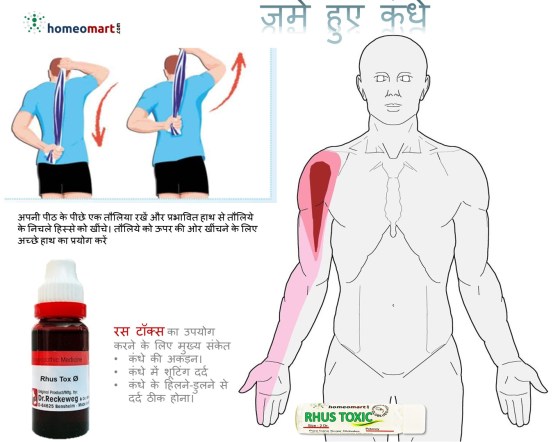 कंधे की अकड़न (फ्रोजन शोल्डर) के कारण, लक्षण और घरेलू इलाज