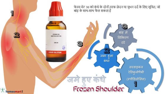 कंधे की अकड़न का खुद इलाज करने के तरीके