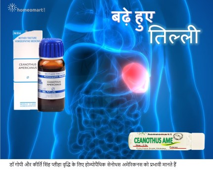 तिल्ली में सूजन के लक्षण प्लीहा का चित्र