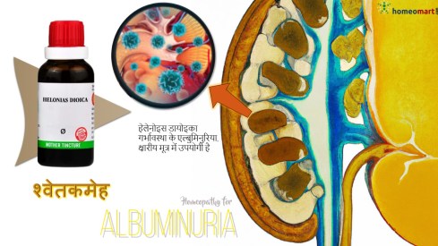 यूरिन में प्रोटीन आने का इलाज