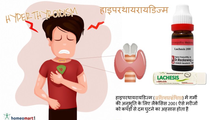 होम्योपैथी हाइपरथायरायडिज्म दवाएं