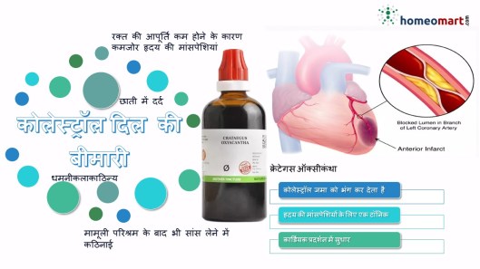 कोलेस्ट्रॉल बढ़ने के लक्षण