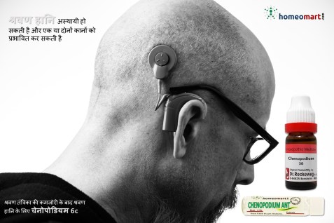 श्रवण हानि उपचार होम्योपैथी दवाएं