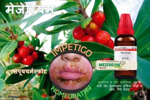 इम्पेटिगो होम्योपैथी दवा
