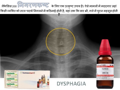 थूक निगलने में दर्द