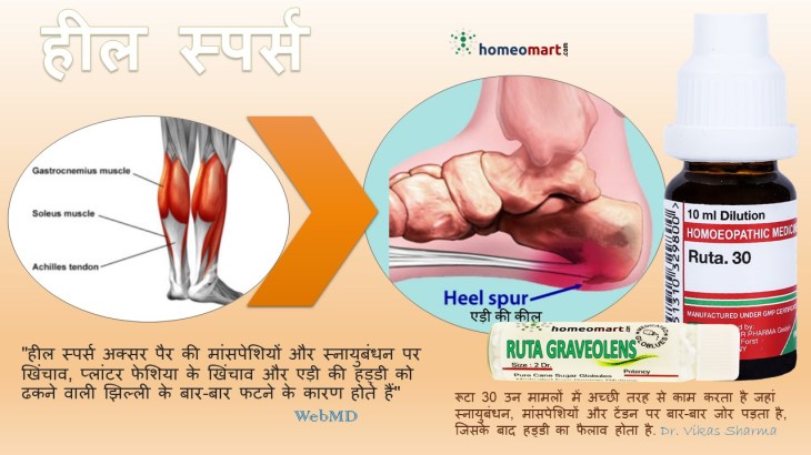 हील स्पर