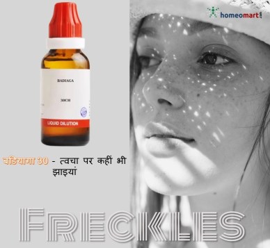 चेहरे पर चित्तीदार दाग