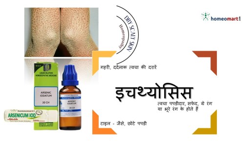 फिश स्किन डिजीज 