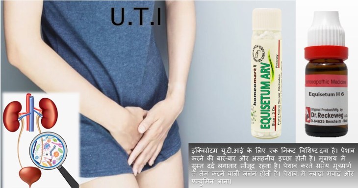 यूटीआई के लक्षण, कारण, इलाज, दवा,