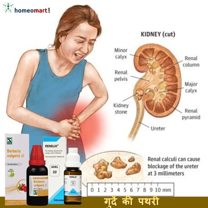 urine blockage treatment in hindi