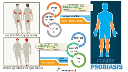 सोरायसिस उपचार होम्योपैथी दवाएं