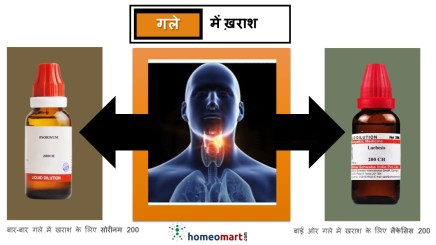 गले में खराश के उपाय