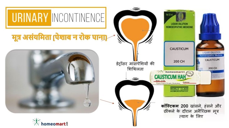 यूरिन लीकेज होमियोपैथी ट्रीटमेंट